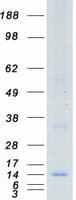 Human CD225 / IFITM1 Protein (Recombinant Myc-DDK (Flag))