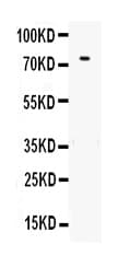 Polyclonal Rabbit anti-Human TF / Transferrin Antibody (aa20-698, IHC, WB)