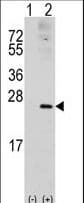 RAC1 Antibody (Ser71)