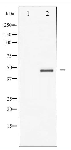 GSK3B / GSK3 Beta Antibody