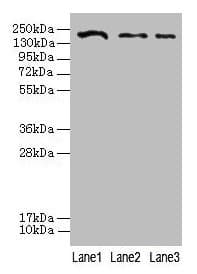 CLTCL1 / CHC22 Antibody