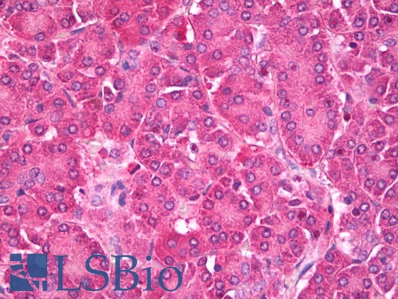 IHC-plus™ HDAC5 Antibody
