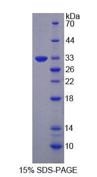 Human GLNRS / QARS Protein (Recombinant His-T7, N-terminus)