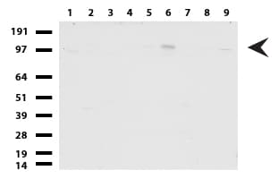 GLI / GLI1 Antibody (aa1-410, clone UMAB170)