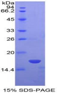 Human NME4 Protein (Recombinant His-T7)