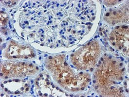 ALOX15 / 15-Lipoxygenase Antibody (clone OTI2G3)