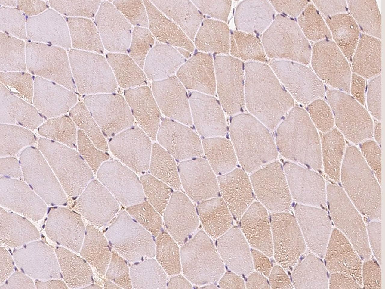 CX3CL1 / Fractalkine Antibody