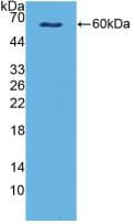 SPINK5 / LEKTI Antibody (aa734-995)
