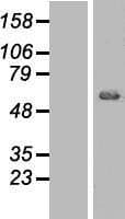 AKT1 Protein (Over-Expression Lysate Myc-DDK (Flag))