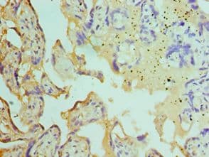 Polyclonal Rabbit anti-Human ST14 / Matriptase Antibody (aa566-855, IHC)