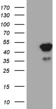 TFEC Antibody (clone OTI1B4)