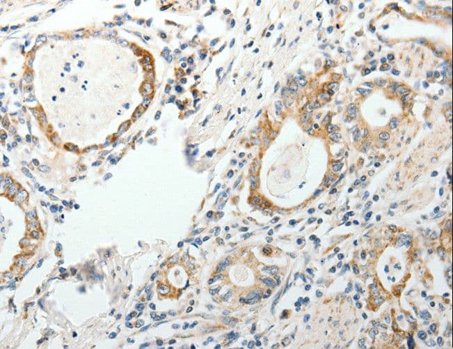 SIP1 Antibody