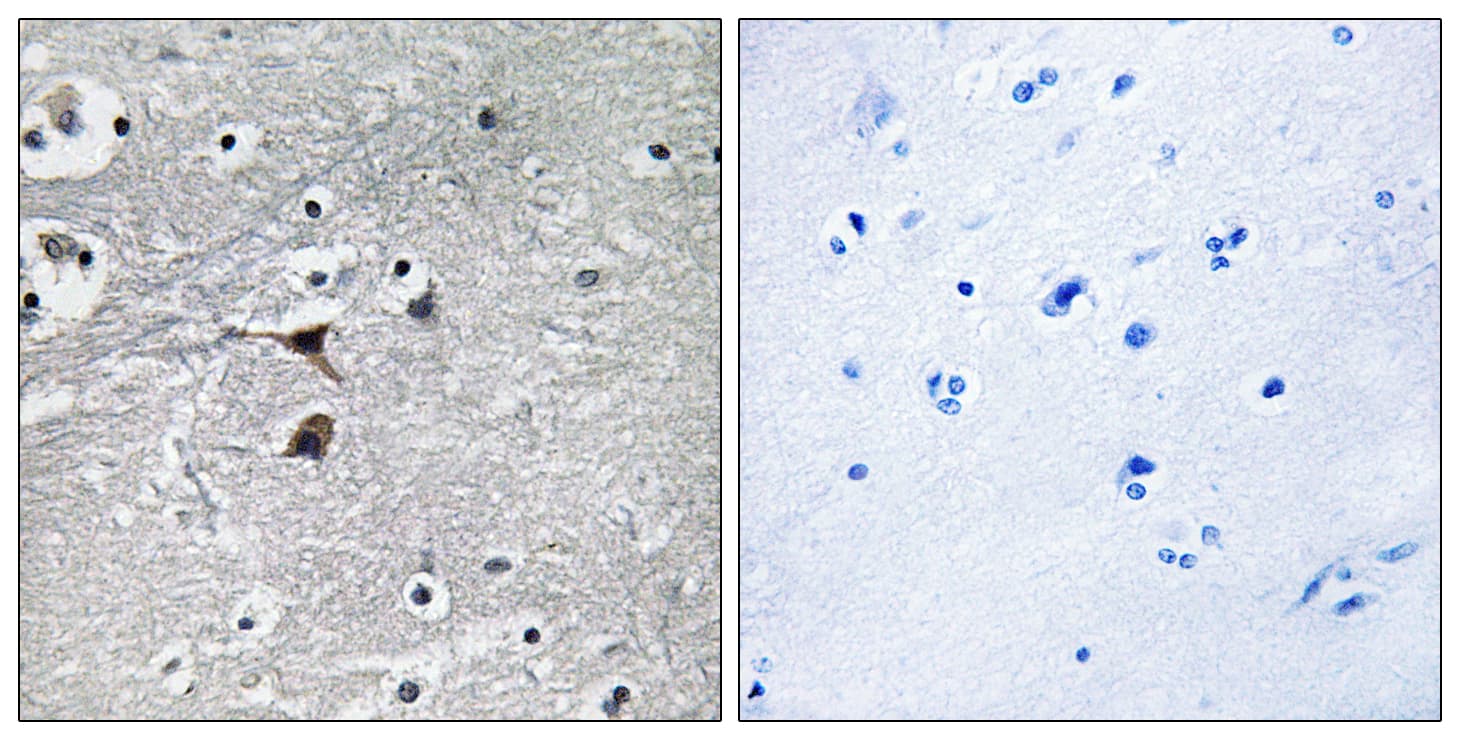 TPH1 / Tryptophan Hydroxylase Antibody (aa231-280)