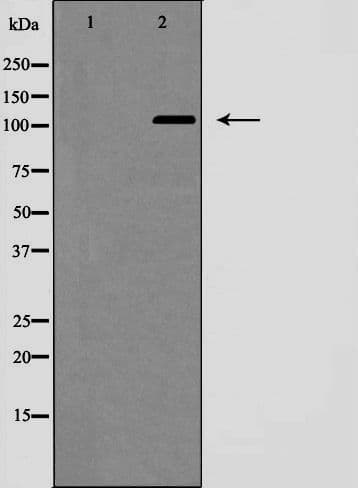 NOTCH2 Antibody (Cleaved Ala1734)