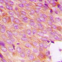 DOK2 Antibody (phospho-Tyr299)