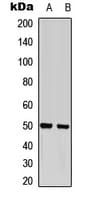 Polyclonal Rabbit anti-Human GFAP Antibody (N-Terminus, IHC, IF, WB)