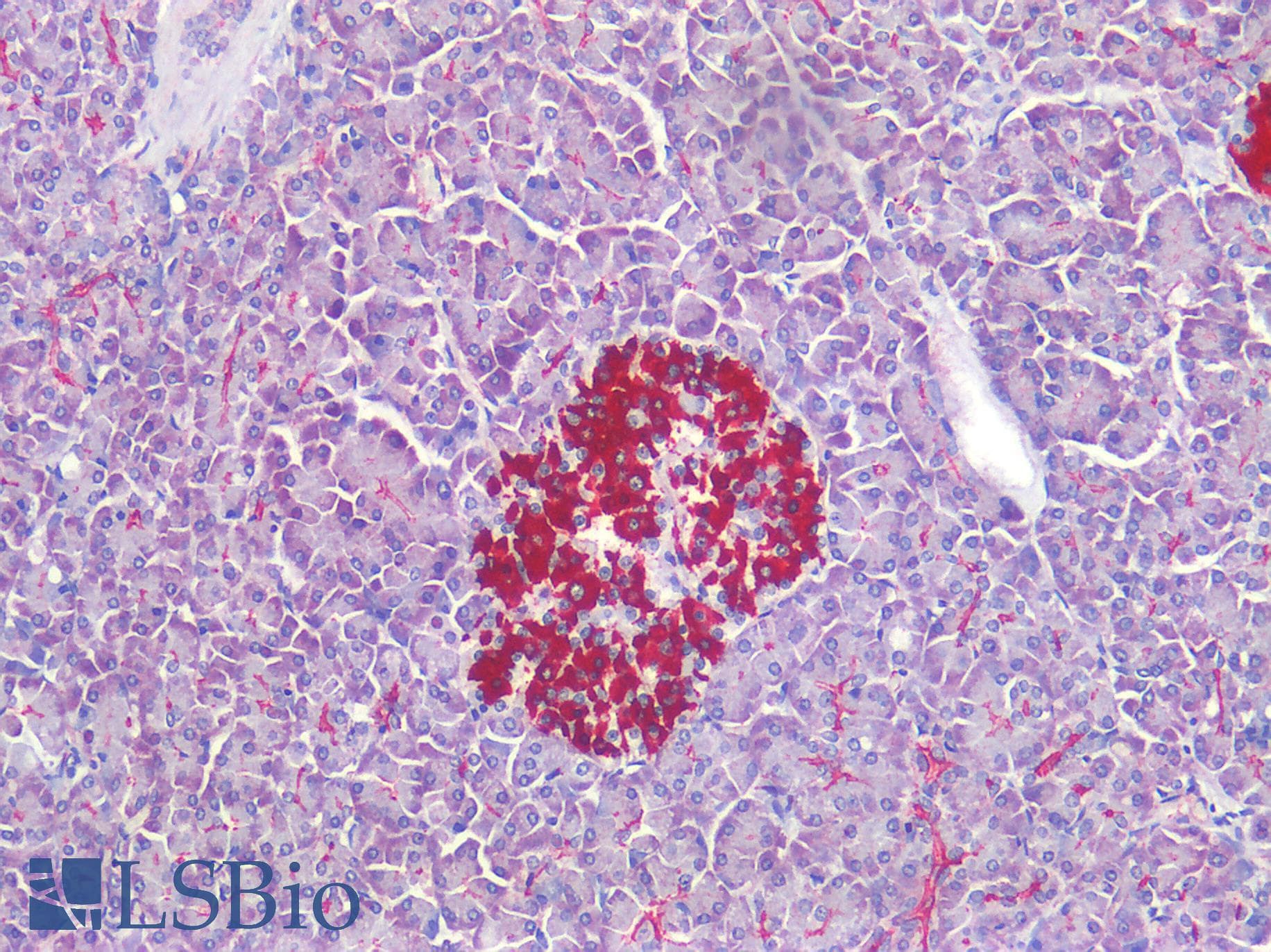 IHC-plus™ Polyclonal Rabbit anti-Human HTR1E / 5-HT1E Receptor Antibody (Cytoplasmic Domain, IHC)