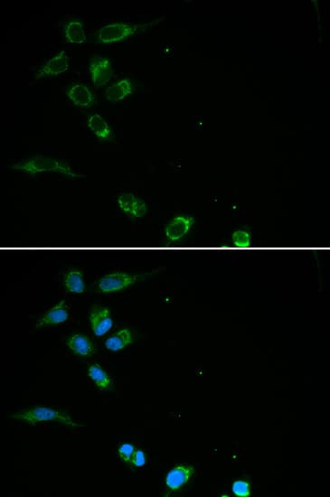 Polyclonal Rabbit anti-Human HFE Antibody (IHC, IF, WB)