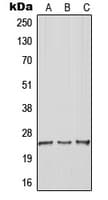 Polyclonal Rabbit anti-Human ARHGDIG / RHOGDI-3 Antibody (Internal, WB)
