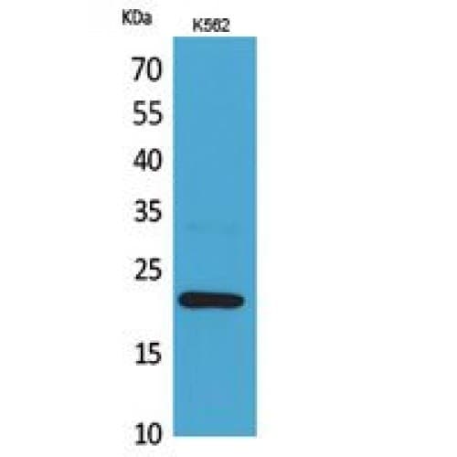 IL6 / Interleukin 6 Antibody (Internal)