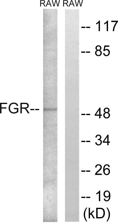 Polyclonal Rabbit anti-Human FGR Antibody (aa381-430, WB)