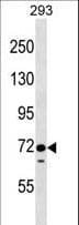 Polyclonal Rabbit anti-Human EPS8L1 Antibody (aa1-30, WB)