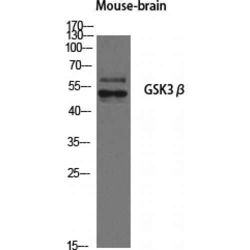 Polyclonal Rabbit anti-Human GSK3B / GSK3 Beta Antibody (1-80 aa, IHC, WB)