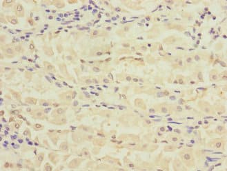 Polyclonal Rabbit anti-Human RPIA / RPI Antibody (IHC, WB)