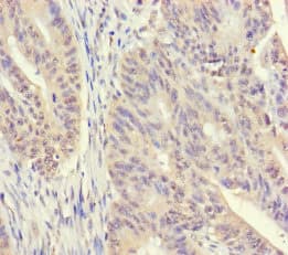 Polyclonal Rabbit anti-Human SRM / Spermidine Synthase Antibody (IHC, WB)