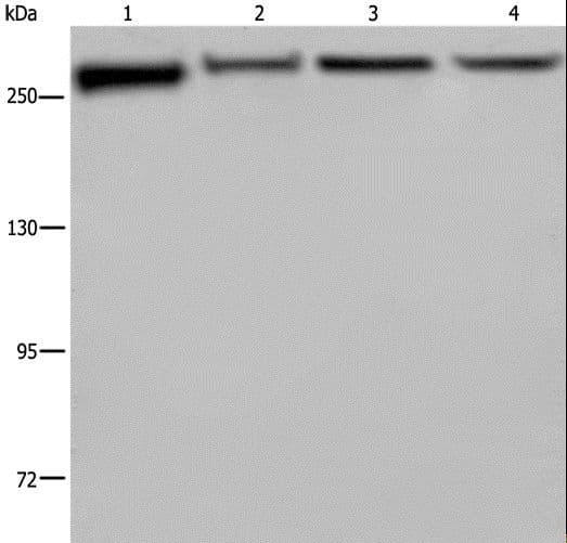 Polyclonal Rabbit anti-Human FLNA / Filamin A Antibody (IHC, WB)