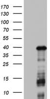 Monoclonal Mouse anti-Human DOCK2 Antibody (clone OTI7G2, aa1544-1830, IHC, WB)