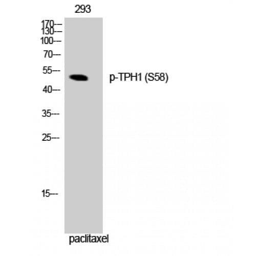 Polyclonal Rabbit anti-Human TPH1 / Tryptophan Hydroxylase Antibody (40-120 aa, IHC, WB)