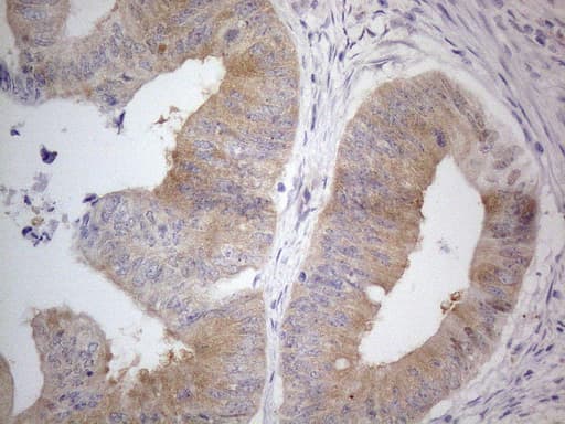 PRMT5 Antibody (aa238-499, clone OTI2H3)