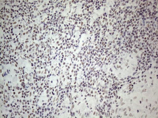 NR2C2 / TAK1 Antibody (aa1-241, clone OTI2H2)