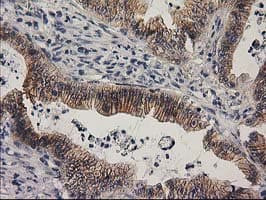 Monoclonal Mouse anti-Human EIF4E2 / IF4e Antibody (clone OTI1F2, IHC, WB)