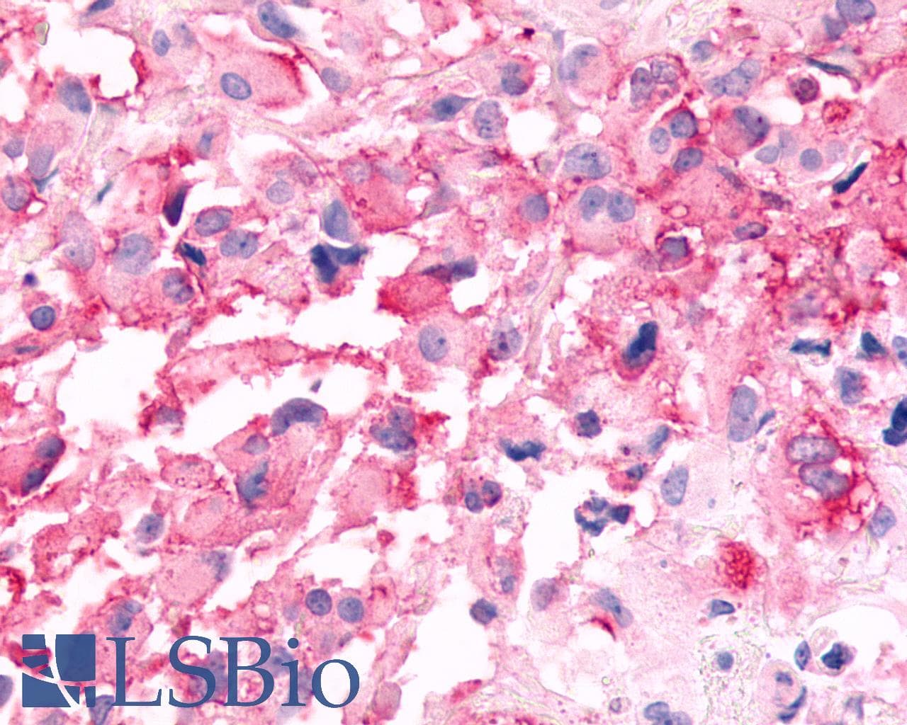 PathPlus™ CELSR3 Antibody (N-Terminus)