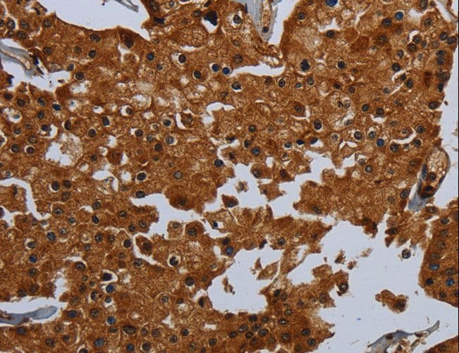 Polyclonal Rabbit anti-Human ENTPD7 Antibody (IHC)