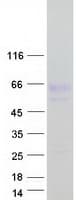 Human NYX Protein (Recombinant Myc-DDK (Flag))