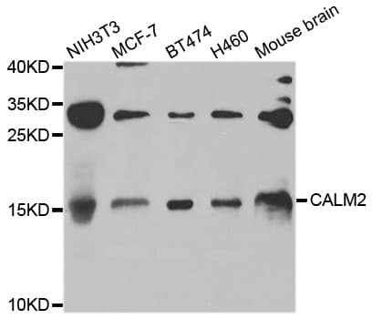 Polyclonal Rabbit anti-Human CALM2 / Calmodulin 2 Antibody (WB)