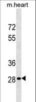 HOXB13 Antibody (aa223-251)