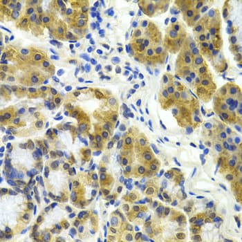 Polyclonal Rabbit anti-Human ERCC1 Antibody (IHC, IF, WB)
