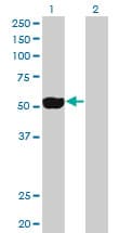 IHC-plus™ NEK2 Antibody (clone 2F6)