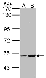 Polyclonal Rabbit anti-Human EFCAB14 Antibody (aa243-495, IHC, WB)