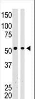 Polyclonal Rabbit anti-Human BAIAP2 / IRSP53 Antibody (aa492-518, IHC, WB)