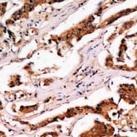 Polyclonal Rabbit anti-Human TIMM10B / FXC1 Antibody (IHC, WB)