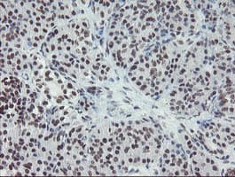 MLF2 Antibody (clone OTI1E3)