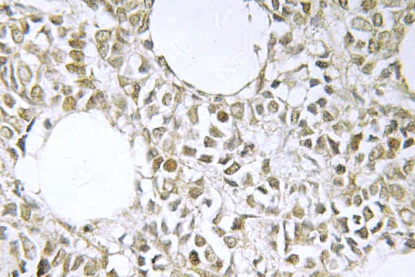 IKBKG / NEMO / IKK Gamma Antibody (His81)