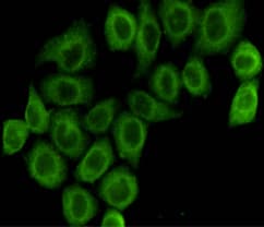 Monoclonal Mouse anti-Human PDHA1 / PDH E1 Alpha Antibody (WB)