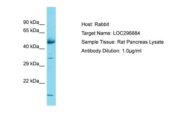 GLCCI1 Antibody (aa255-304)