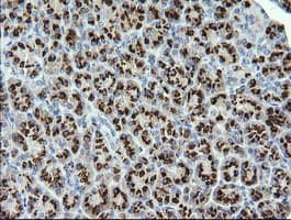 STK38L / NDR2 Antibody (clone OTI3E10)